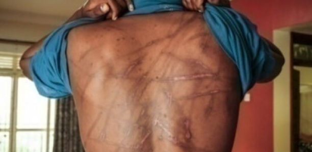 Ziguinchor: Un garde pénitentiaire envoyé en prison pour actes de torture sur un détenu (19 ans) accusé de viol