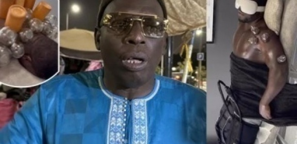Blessure de Reug Reug : Son manager Palla Diop annonce une contre-expertise médicale