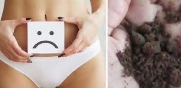 Kolda : le Tabac vaginal, la nouvelle trouvaille pour des orgasmes qui durent mais pas sans conséquence sur la santé gynécologique des femmes