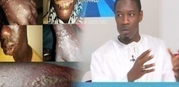 Pape Djibril Fall sur la « Maladie des pêcheur » : « Lithi Gueuna méti moy Etat bi… »