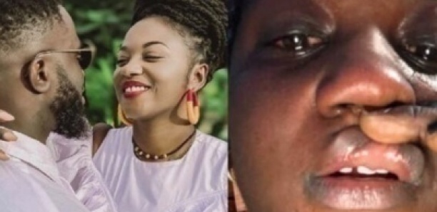 Mia des « Maabo » sauvagement battue par son ex mari ? Les images qui choquent