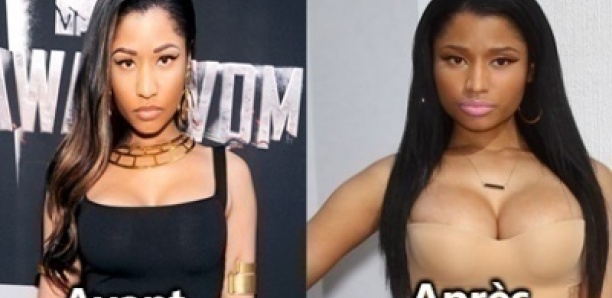 « J’allais bien comme j’étais » – Nicki Minaj regrette d’avoir subi une chirurgie plastique