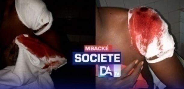 MBACKÉ - Un enseignant sauvagement agressé ! Bouba qui a perdu beaucoup de son sang, a aussi failli perdre son épaule