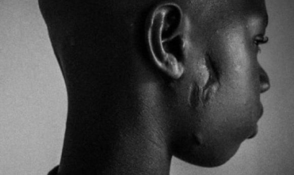 «brûlé Aux Fesses», «étranglé»… : Un Talibé Raconte Son Calvaire, Son Maître Coranique Arrêté, L’assistant En Fuite