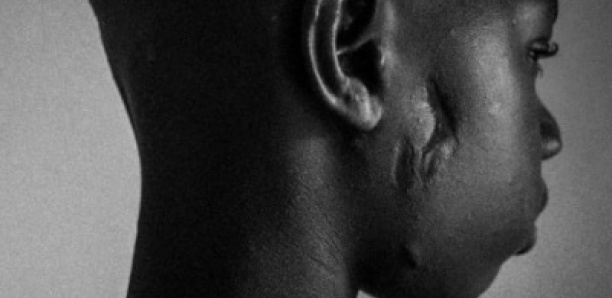 «Brûlé aux fesses», «étranglé»… : un talibé raconte son calvaire, son maître coranique arrêté, l’assistant en fuite