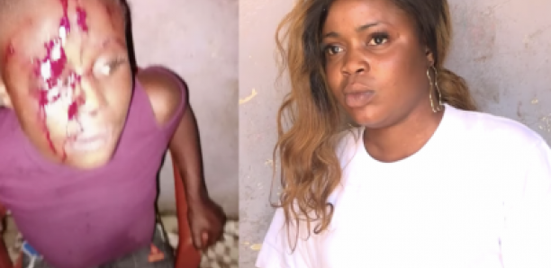 GUEDIAWAYE: Diatou attaquée par son ex-mari « Beut Bi La Yaak »