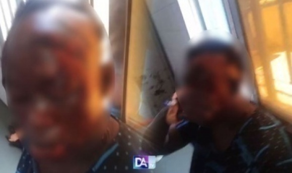 Mac De Diourbel – Maty F., Une Femme Ayant ébouillanté L’épouse De Son Frère à Mbacké, Placée Sous Mandat De Dépôt Après Avoir Invoqué Des Problèmes De Santé