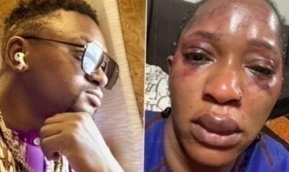 Azaya Et Djelykaba Bintou : Un Couple Star Dans La Tourmente D’un Cercle De Feu