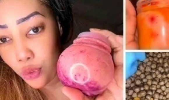 Affaire Des Boulettes : Bonne Nouvelle Pour «alima Suppo»