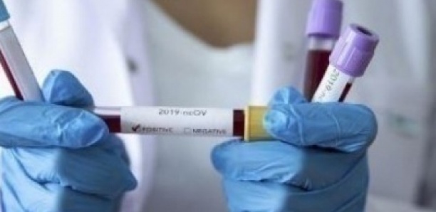 COVID-19: Ce qu’on sait des 236 malades déclarés guéris
