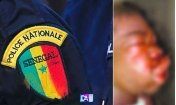 Rosso – Supplice Au Commissariat : Talla Keita, 18 Ans, Battu, Brisé… Puis Emporté Par Une Septicémie…le Procureur Ordonne Une Enquête Judiciaire Complète Et Une Autopsie