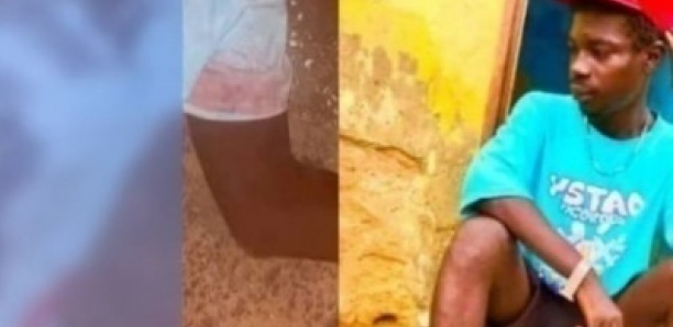 Mort suspecte à Rosso : ce que révèle l’autopsie du jeune homme de 18 ans