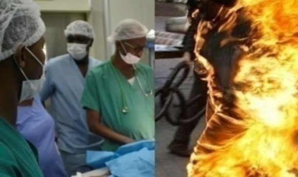 Ziguinchor : Des Nouvelles De Khady, La Fillette Brûlée Par Son Père