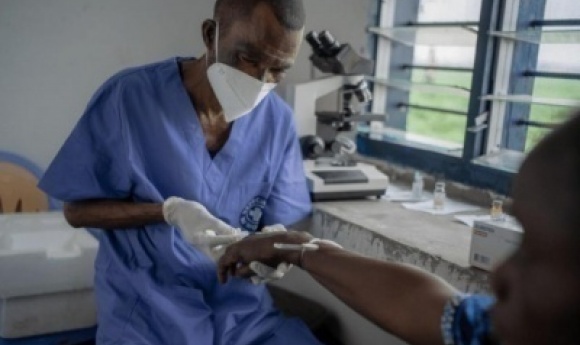Mpox Au Sénégal : La Vérité Sur Les Cas Contacts