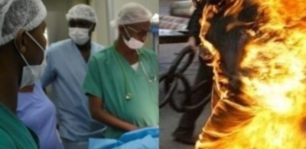Ziguinchor : Des nouvelles de Khady, la fillette brûlée par son père