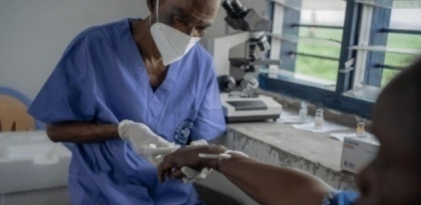 Mpox au Sénégal : la vérité sur les cas contacts