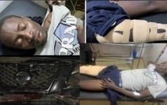 Mbaye Lambar, Cloué Au Lit Depuis 2 Jours Sans être Soigné. La Raison Est Triste…